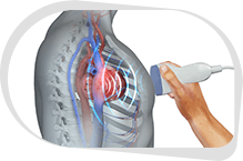 Echocardiography