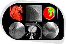 Nuclear Cardiology