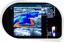 Peripheral Arterial & Venous Ultrasound