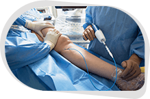 Peripheral Artery Catheterization