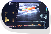 Vascular Duplex  Ultrasonography  & Plethysmography